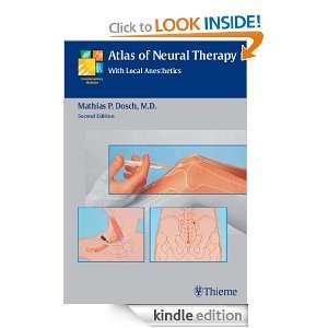 Atlas of Neural Therapy With Local Anesthetics Mathias Dosch  