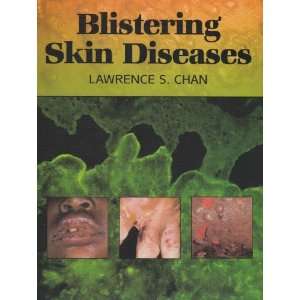   Blistering Skin Diseases [Hardcover] Lawrence S. Chan Books