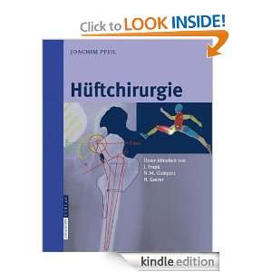 Hüftchirurgie (German Edition) Joachim Pfeil, J. Frank, N.M. Gumpert 